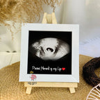 Tiny Miracle Scan – Mini Photo Frame 👶✨